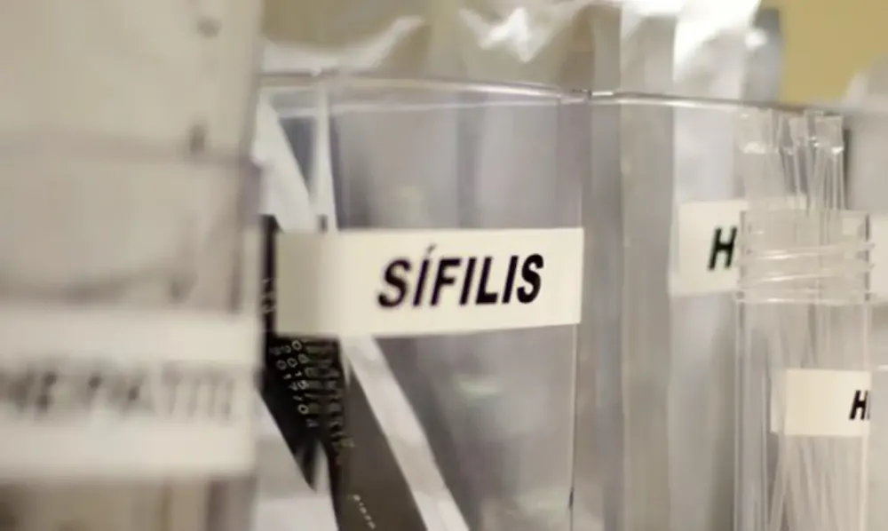 Sífilis continua em ritmo acelerado de crescimento no país